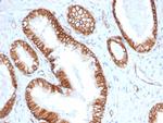 Catenin, beta (CTNNB1) Antibody in Immunohistochemistry (Paraffin) (IHC (P))