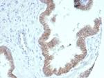 Catenin, beta (CTNNB1) Antibody in Immunohistochemistry (Paraffin) (IHC (P))