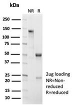 Catenin, beta (CTNNB1) Antibody in SDS-PAGE (SDS-PAGE)