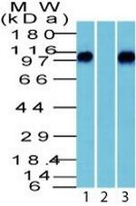 Catenin, beta (p120) Antibody in Western Blot (WB)