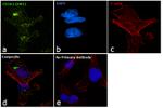 CD262 (DR5) Antibody in Immunocytochemistry (ICC/IF)