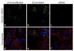 CD262 (DR5) Antibody in Immunocytochemistry (ICC/IF)