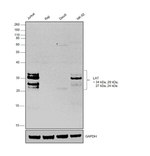 LAT Antibody in Western Blot (WB)