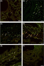 CD279 (PD-1) Antibody in Immunohistochemistry (Frozen) (IHC (F))