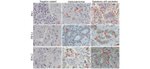 CD279 (PD-1) Antibody in Immunohistochemistry (IHC)