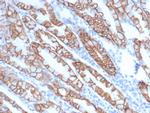 p120/Catenin delta-1 (CTNND1) Antibody in Immunohistochemistry (Paraffin) (IHC (P))