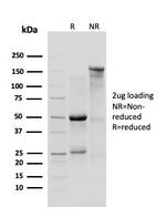 p120/Catenin, delta-1 (CTNND1) Antibody in SDS-PAGE (SDS-PAGE)