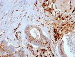 Cathepsin D Antibody in Immunohistochemistry (Paraffin) (IHC (P))