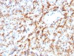 Cathepsin D Antibody in Immunohistochemistry (Paraffin) (IHC (P))