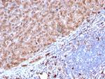 Cathepsin D Antibody in Immunohistochemistry (Paraffin) (IHC (P))