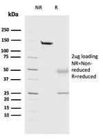 Cathepsin D Antibody in SDS-PAGE (SDS-PAGE)