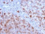 Cathepsin D Antibody in Immunohistochemistry (Paraffin) (IHC (P))