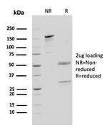 Cathepsin D Antibody in SDS-PAGE (SDS-PAGE)