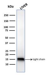 Cathepsin D Antibody in Western Blot (WB)