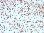 Cathepsin D Antibody in Immunohistochemistry (Paraffin) (IHC (P))