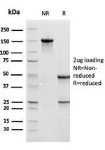 Cathepsin D Antibody in SDS-PAGE (SDS-PAGE)