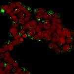 Cathepsin D Antibody in Immunocytochemistry (ICC/IF)