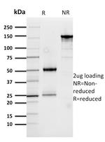 Cathepsin D Antibody in SDS-PAGE (SDS-PAGE)