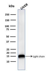 Cathepsin D Antibody in Western Blot (WB)