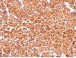 Cathepsin D (Tumor Marker) Antibody in Immunohistochemistry (Paraffin) (IHC (P))