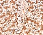 Cathepsin D (Tumor Marker) Antibody in Immunohistochemistry (Paraffin) (IHC (P))