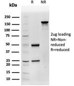 Cathepsin D (Tumor Marker) Antibody in SDS-PAGE (SDS-PAGE)