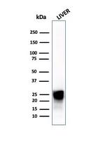 Cathepsin D (Tumor Marker) Antibody in Western Blot (WB)