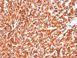 Cathepsin D (Tumor Marker) Antibody in Immunohistochemistry (Paraffin) (IHC (P))