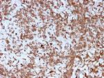 Cathepsin K Antibody in Immunohistochemistry (Paraffin) (IHC (P))