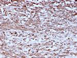 Cathepsin K Antibody in Immunohistochemistry (Paraffin) (IHC (P))