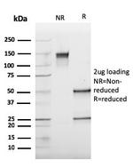 Cathepsin K Antibody in SDS-PAGE (SDS-PAGE)