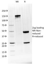 BTLA Antibody in SDS-PAGE (SDS-PAGE)