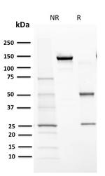 Cytochrome P450 1A1/1A2 Antibody in SDS-PAGE (SDS-PAGE)