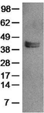 LAP (Latency Associated peptide) Antibody in Western Blot (WB)