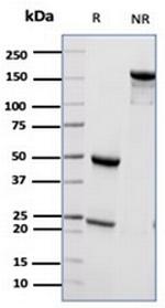 CD55/Decay Accelerating Factor (DAF) Antibody in SDS-PAGE (SDS-PAGE)