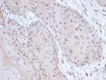 DAXX (Transcriptional Corepressor) Antibody in Immunohistochemistry (Paraffin) (IHC (P))