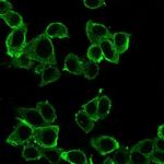 DAXX Antibody in Immunocytochemistry (ICC/IF)