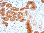 DAXX Antibody in Immunohistochemistry (Paraffin) (IHC (P))