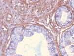 Drebrin 1 (DBN1) Antibody in Immunohistochemistry (Paraffin) (IHC (P))