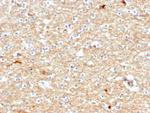 Drebrin 1 (DBN1) Antibody in Immunohistochemistry (Paraffin) (IHC (P))