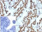 Zinc Finger Protein 846/ZNF846 Antibody in Immunohistochemistry (Paraffin) (IHC (P))