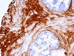 Decorin Antibody in Immunohistochemistry (Paraffin) (IHC (P))