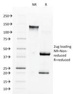 Angiotensin I Converting Enzyme (ACE)/CD143 Antibody in SDS-PAGE (SDS-PAGE)