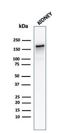 Angiotensin I Converting Enzyme (ACE)/CD143 Antibody in Western Blot (WB)