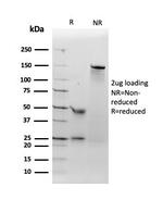 Angiotensin I Converting Enzyme (ACE)/CD143 Antibody in SDS-PAGE (SDS-PAGE)