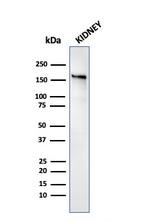 Angiotensin I Converting Enzyme (ACE)/CD143 Antibody in Western Blot (WB)