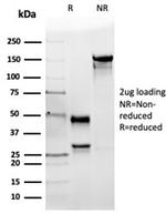 Angiotensin I Converting Enzyme (ACE)/CD143 Antibody in SDS-PAGE (SDS-PAGE)