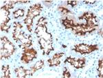 Angiotensin I Converting Enzyme (ACE)/CD143 Antibody in Immunohistochemistry (Paraffin) (IHC (P))