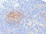 Aldo-keto Reductase Family 1 Member C1/DD1 Antibody in Immunohistochemistry (Paraffin) (IHC (P))