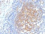 Aldo-keto Reductase Family 1 Member C1/DD1 Antibody in Immunohistochemistry (Paraffin) (IHC (P))